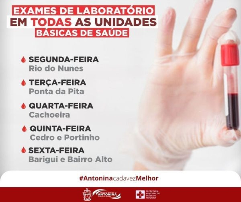 Exames Laboratoriais agora nas Unidades Básicas de Saúde de Antonina 